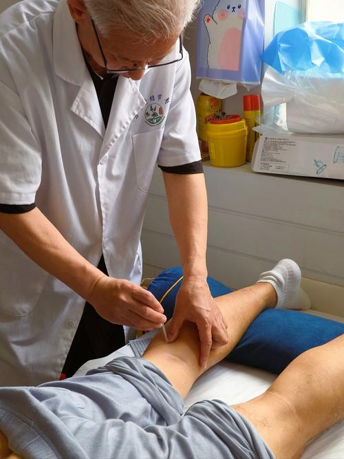 为了更熟练 医学生在自己身上练针灸