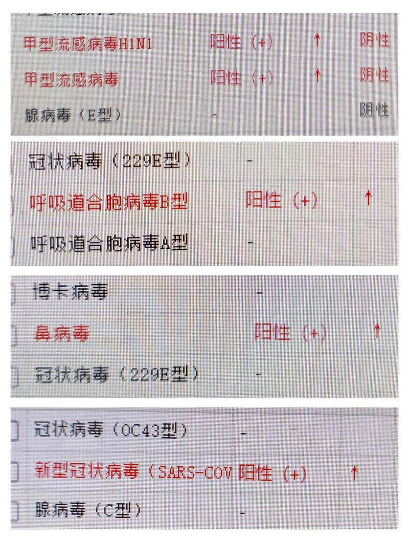 毒株与去年不同！流感进入高发季